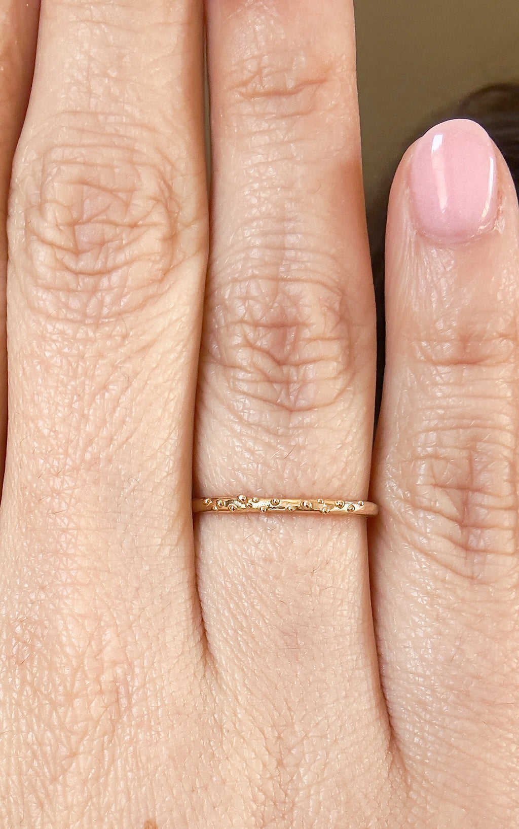 Mist Ring